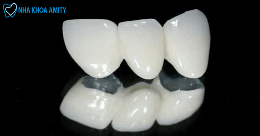 Răng Sứ Titanium