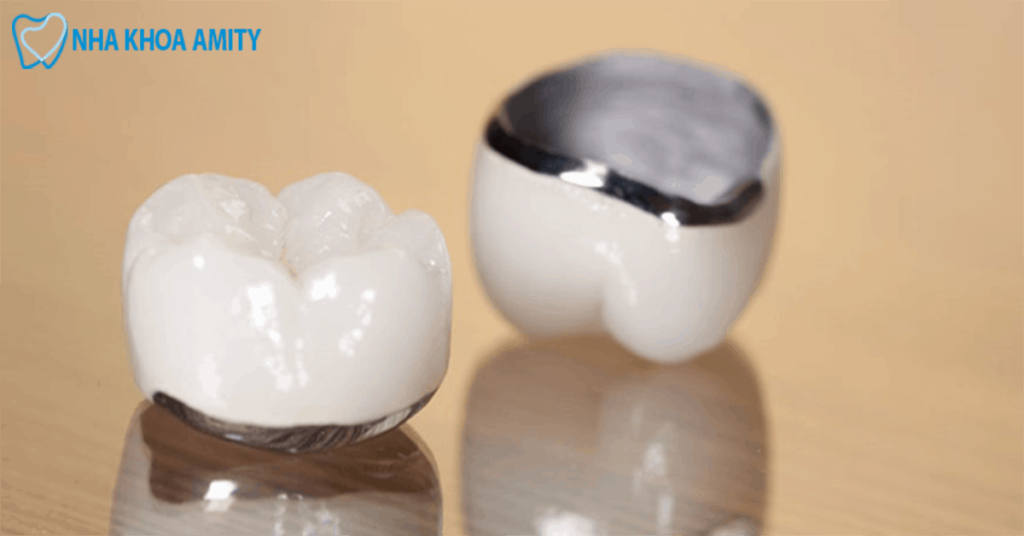 Răng Sứ Cromcobalt