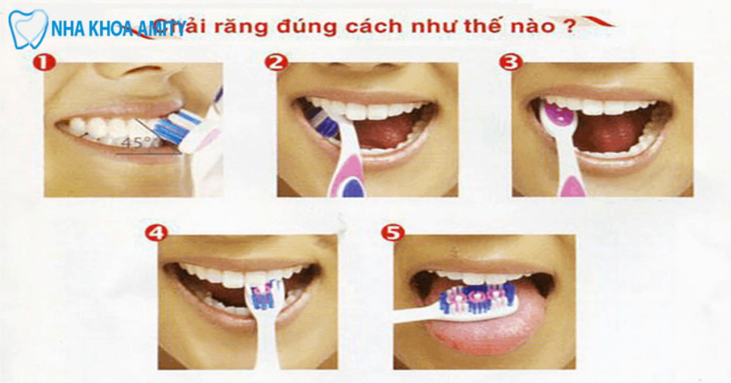 Chải răng đúng cách