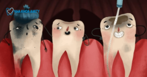 Cách Xác Định Răng Áp Xe