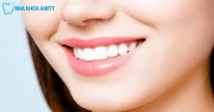 Hàm Răng Đẹp Là Như Thế Nào? Các Yếu Tố Quyết Định