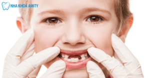 Bị Sún Răng Thì Phải Làm Sao?