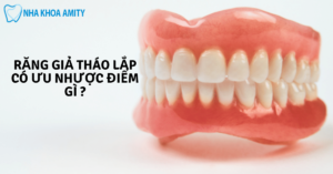 Làm Răng Giả Tháo Lắp Có Những Ưu Điểm Gì?