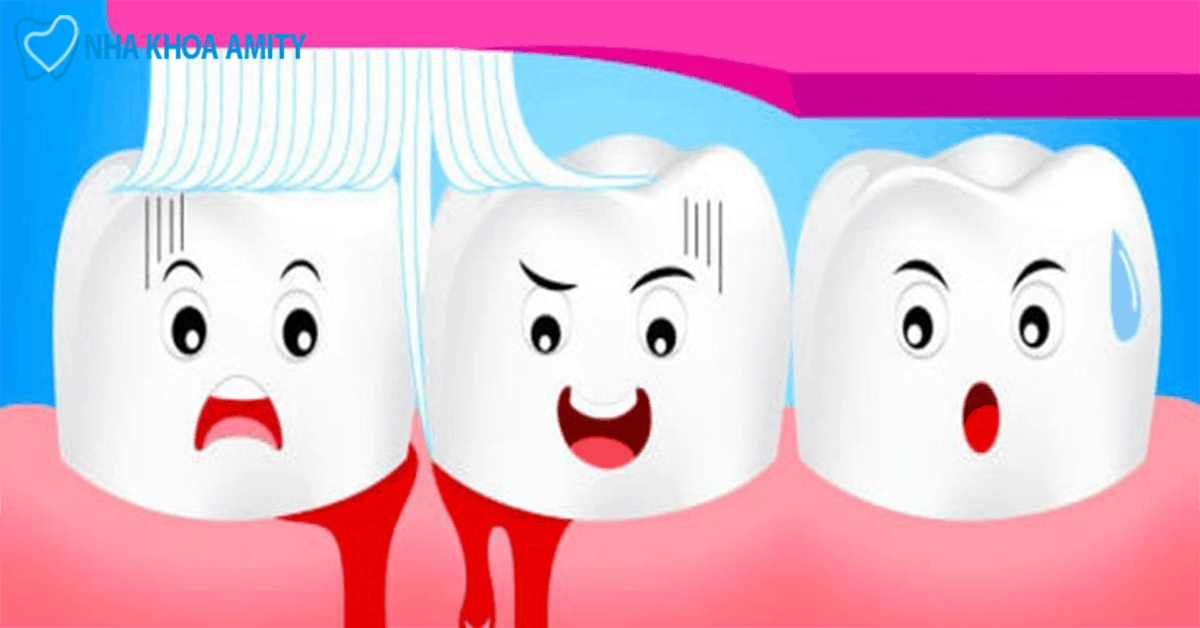 Bàn Chải Đánh Răng Thô Cứng