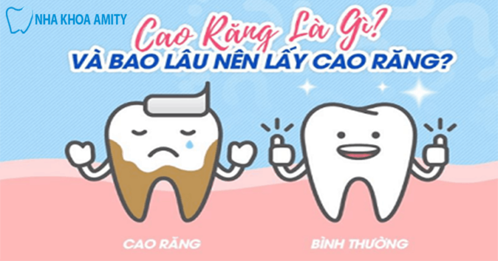 Lấy Vôi Răng Có Đau Không? Có Làm Tổn Hại Men Răng?