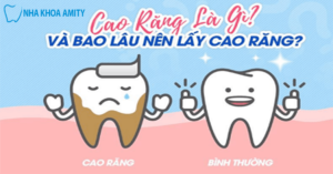 Lấy Vôi Răng Có Đau Không? Có Làm Tổn Hại Men Răng?