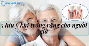 5 Điều Lưu Ý Trồng Răng Cho Người Già
